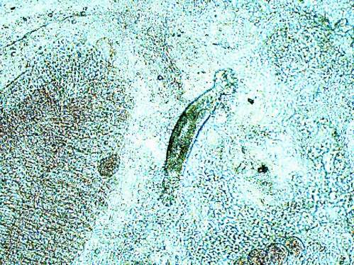 dactylogyrus 1 200x.JPG