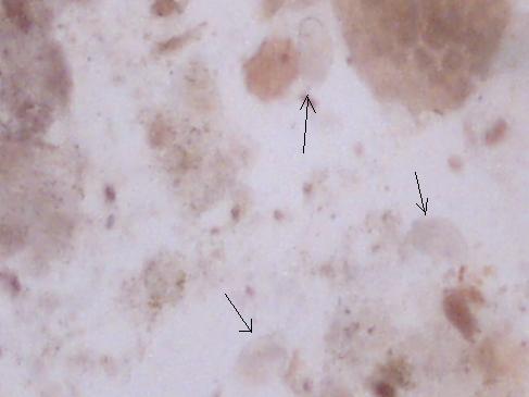 3 dzień po podaniu leku 2.jpg