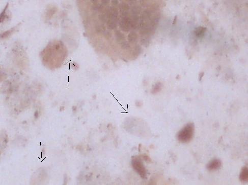 3 dzień po podaniu leku 1.jpg